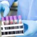 Understanding Bloodborne Pathogens in the Healthcare Industry