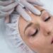Botox Treatment for First-Timers: What to Expect